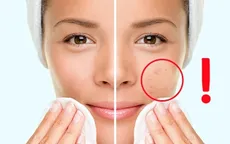Những lưu ý để có một làn da đẹp hoàn hảo