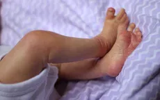 Vì sao bạn cảm thấy ngứa ngáy nhiều vào mùa đông?