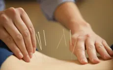 Châm cứu - Phương pháp trị liệu hút khách tại Nga