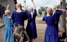 Nỗi đau của những người bạch tạng tại châu Phi