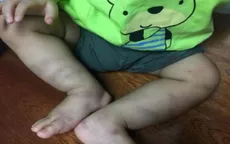 Khởi tố vụ án bạo hành bé trai 1 tuổi ở Hà Nội