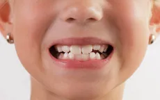 Tật nghiến răng khi ngủ ảnh hưởng sức khỏe như thế nào?