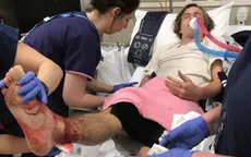 Hiếm hoi thanh niên Australia bị bọ biển tấn công