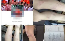 Hà Nội: Tạm đình chỉ giáo viên đánh học sinh tiểu học Nguyễn Tri Phương