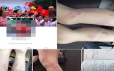 Đề xuất kỷ luật cô giáo đánh học sinh