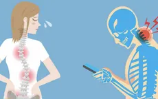 Nguy hiểm tình trạng biến dạng cổ do dùng điện thoại thông minh