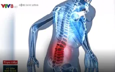Phương pháp điều trị bệnh đau thắt lưng