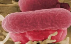 Mỹ thu hồi bơ đậu nành nhiễm khuẩn E.coli