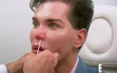 Mũi của "búp bê sống" Rodrigo Alves có thể rơi ra