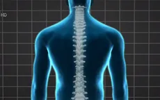 Liệu pháp gây tê màng cứng giúp người bị liệt đi lại được