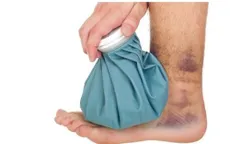 4 bước nên làm, 4 điều nên tránh khi bị chấn thương phần mềm