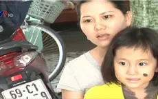 Cà Mau: Cô bé mắc bệnh "người sói" rất cần sự hỗ trợ