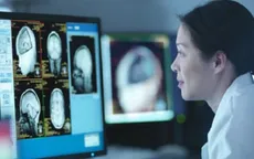 Não người vẫn nhận thức được dù cơ thể đã chết