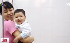 100 em nhỏ hở hàm ếch sẽ được hỗ trợ tái tạo nụ cười