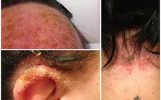 Chỉ vì nhuộm tóc, người phụ nữ này suýt mất mạng