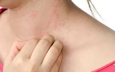 Cách phòng tránh dị ứng thời tiết mùa Thu