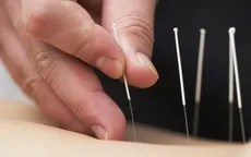Điều trị cho trẻ tự kỷ bằng châm cứu, cấy chỉ