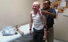 Cánh tay mới dành cho em bé bạch tạng Tanzania tại Mỹ