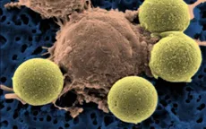 FDA phê duyệt thuốc trị bệnh bạch cầu mới