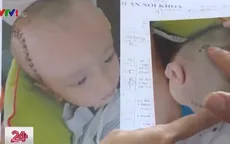 Bé 3 tuổi phải phẫu thuật vì bị chấn thương sọ não ở trường