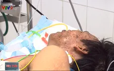 Số ca uốn ván gia tăng, người dân vẫn lơ là