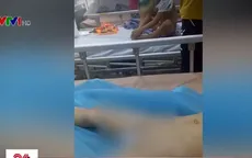 Nhiều bé trai bị viêm nhiễm bộ phận sinh dục sau khi cắt bao quy đầu