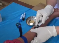 Nguyên nhân gây viêm cầu thận tại Nghệ An do liên cầu khuẩn nhóm A