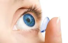 Sau mổ mắt bao lâu thì được đeo lens áp tròng?