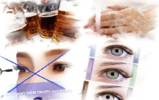 Những điều cần kiêng kỵ trước và sau khi mổ mắt cận thị
