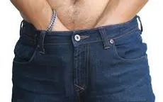 Viêm quy đầu dị ứng: Nguyên nhân và điều trị