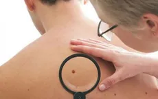 Báo động gia tăng tỷ lệ tử vong do bệnh ung thư da ở nam giới