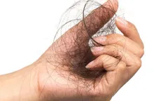 10 thay đổi trên cơ thể cảnh báo tình trạng sức khỏe mà bạn cần chú ý