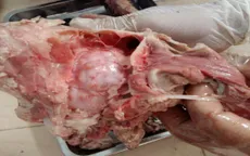 Bình Phước: Phát hiện ổ bệnh hơn trăm người mắc sán dây lợn