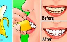 Khám phá công dụng làm đẹp không ngờ bằng vỏ chuối