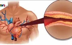Phát hiện mới: Lượng cholesterol tốt quá cao dễ gây đau tim