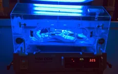 Vàng da ở trẻ sơ sinh: nguy hiểm nếu phát hiện muộn