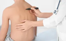 Phòng bệnh cong vẹo cột sống cho trẻ