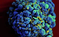 Các nhà khoa học Pháp đã tìm ra cách tiêu diệt các tế bào bị nhiễm HIV