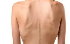 Gầy quá khó mang thai
