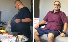 Tưởng “bụng bia” hóa ra là khối u nặng 35 kg
