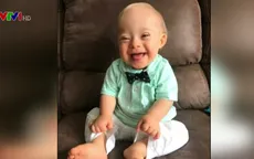 Gerber chọn bé trai mắc hội chứng Down làm gương mặt đại diện