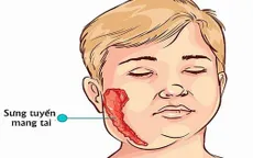 Cảnh báo: Viêm tinh hoàn do quai bị có thể dẫn tới vô sinh