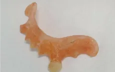 Uống nước, nuốt luôn răng giả