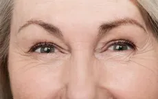 Bí mật của những nếp nhăn