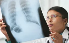 Chẩn đoán sớm ung thư phổi