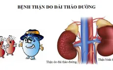 Mối liên hệ hai chiều giữa bệnh thận và đái tháo đường