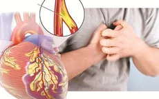 Phát hiện và điều trị bệnh động mạch vành