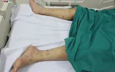 Vì sao viêm não mô cầu lại nguy hiểm?