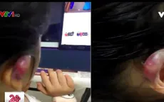 Những vụ bạo hành trẻ em trên thế giới gây phẫn nộ dư luận