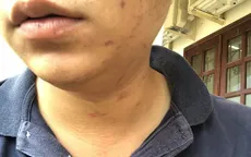 TP.HCM: Xem xét khởi tố vụ đánh nhà báo, kiểm sát viên